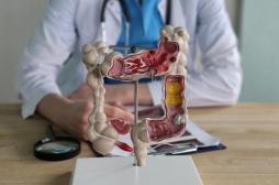 Cancer colorectal : sommes-nous tous égaux ?