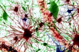 Epilepsie : un nouveau modèle révolutionne la compréhension de la maladie