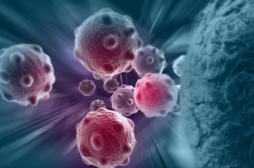 Cancer : une nouvelle méthode permet d'estimer le degré de malignité d'une tumeur
