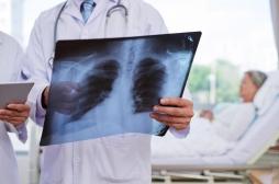 Pneumonie : les effets inattendus d’un médicament contre l’ostéoporose