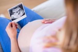 Pourquoi les césariennes seraient liées à une hausse des décès maternels ?