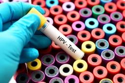Cancer du col de l’utérus : un dépistage HPV tardif chez les femmes âgées limiterait les risques