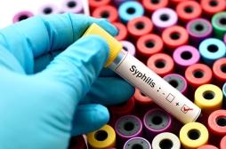 La recrudescence des cas de syphilis s’accompagne de symptômes inhabituels aux USA