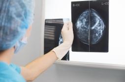 Cancer du sein : “Les pays européens sont probablement les plus avancés au monde dans le dépistage”