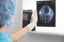 Cancer du sein de Caroline Receveur : qu’est-ce que l’hormonothérapie ?