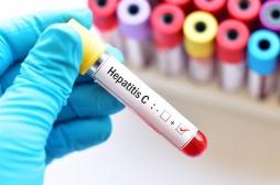 Hépatite C : les recommandations des hépatologues pour éradiquer la maladie d'ici à 2025