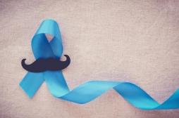 Cancer de la prostate : un nombre de partenaires sexuelles élevé augmente le risque