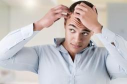 Alopécie : des chercheurs découvrent comment stimuler la repousse des cheveux