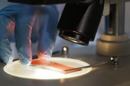 Leucémie : pourrait-on empêcher les rechutes ?