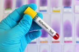 Alzheimer : un test sanguin fiable pour dépister précocement la maladie