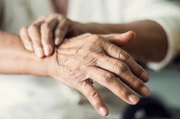 Parkinson : et si des prélèvements cutanés pouvaient détecter la maladie avant l’apparition des symptômes ? 