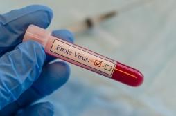 Ebola : le virus peut persister dans le cerveau pendant des années