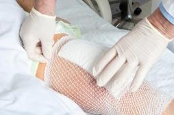 Prothèse du genou : certaines personnes ont plus de risque de complications après l’opération 