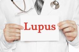 Lupus : le sirolimus efficace dans les formes résistantes aux traitements habituels