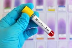Alzheimer : un nouveau test sanguin pour le diagnostic précoce