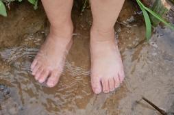 Une fillette revient des tropiques avec cette horrible infection des pieds