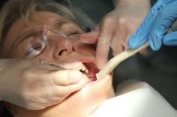 Soins dentaires : une fraise finit dans le poumon d'un patient