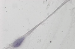 Spermatozoïdes in vitro : encore un long chemin pour les chercheurs lyonnais