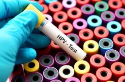 Cancer du col de l'utérus : le test HPV recommandé aux femmes de plus de 30 ans 