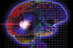 Epilepsie : les cas de mort subite seraient sous-estimés