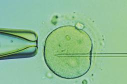 Manipulation d'embryons : feu vert des autorités britanniques