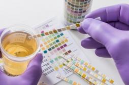 L’urine, un outil fiable pour les scientifiques 