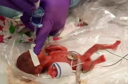 Etats-Unis : le plus petit bébé venu au monde vivant quitte enfin l'hôpital