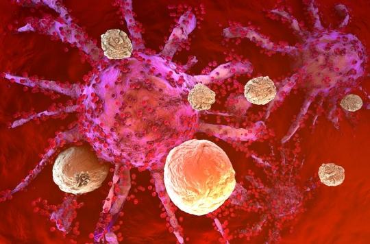 Cancer du col de l’utérus : l’immunothérapie prolonge la survie des patientes