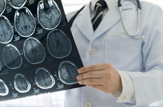 Médicament Androcur : on lui découvre huit tumeurs cérébrales après 10 ans de traitement