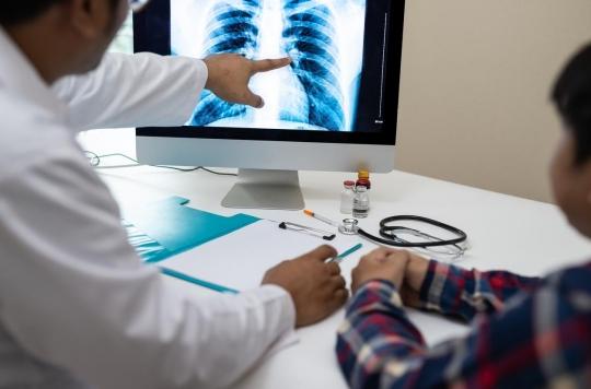 Cancer du poumon : les promesses de l'intelligence artificielle dans le dépistage