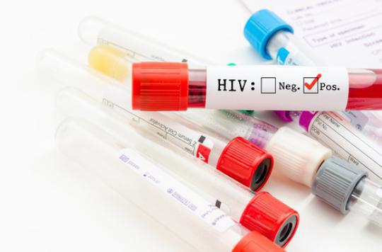 Chine : des autotests VIH au distributeur automatique 