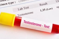 Comment la testostérone influence notre vie sexuelle ? 
