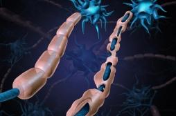 Sclérose en plaques : une protéine d'enveloppe d’un rétrovirus à l'origine de la maladie