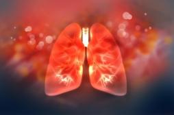 Des particules de microplastiques découvertes dans des poumons humains