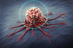 Cancer : des chercheurs découvrent le « talon d’Achille » des tumeurs solides