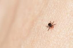 Maladie de Lyme : pourquoi les spécialistes s'indignent-ils des recommandations officielles ?