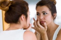Grossesse : l’ANSM recommande l’arrêt des traitements contre l’acné