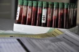 Tuberculose : bientôt un test sanguin pour diagnostiquer les personnes à risque? 