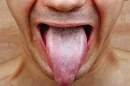 Les probiotiques ou les chewing-gums au xylitol n'ont aucun effet sur l’angine