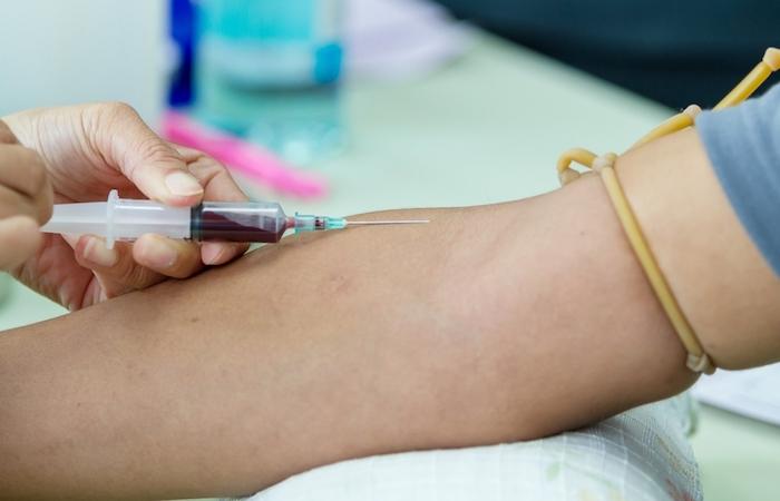 Cancer de la vessie : un test sanguin prédit sa sévérité