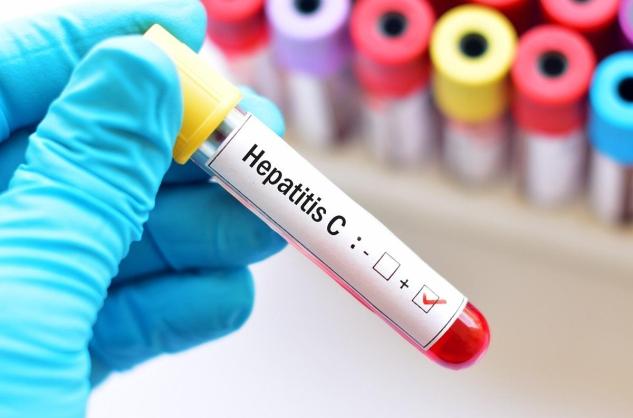 Hépatite C : la 1ère infection virale chronique du foie qui peut guérir