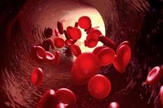 Maladie de Vaquez : la polyglobulie augmente le risque de thromboses  